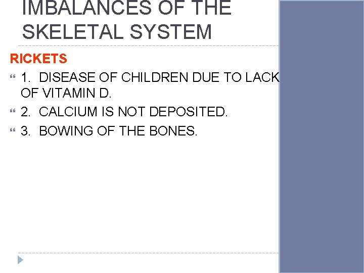 IMBALANCES OF THE SKELETAL SYSTEM RICKETS 1. DISEASE OF CHILDREN DUE TO LACK OF