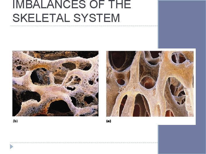 IMBALANCES OF THE SKELETAL SYSTEM 