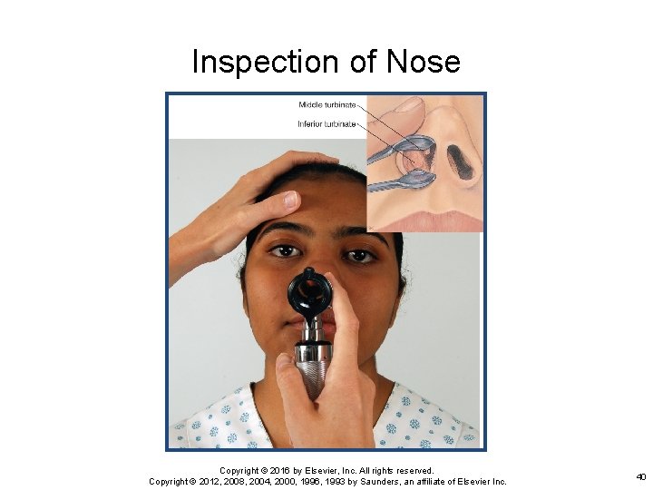 Inspection of Nose Copyright © 2016 by Elsevier, Inc. All rights reserved. Copyright ©