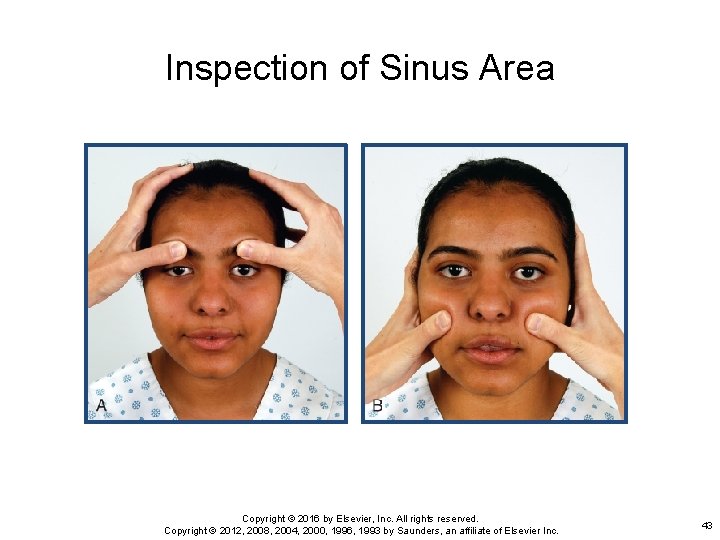 Inspection of Sinus Area Copyright © 2016 by Elsevier, Inc. All rights reserved. Copyright