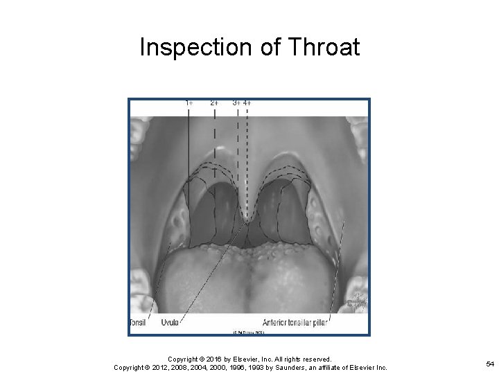 Inspection of Throat Copyright © 2016 by Elsevier, Inc. All rights reserved. Copyright ©