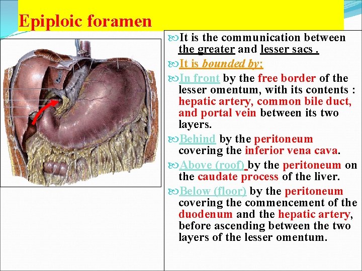 Epiploic foramen It is the communication between the greater and lesser sacs. It is
