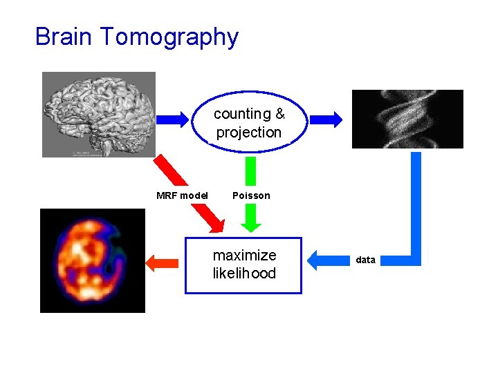 Brain Tomography unknown object statistical& counting projection model prior knowledge MRF model Maximum likelihood