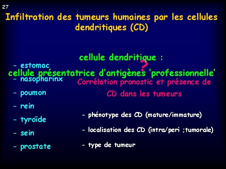 27 Infiltration des tumeurs humaines par les cellules dendritiques (CD) cellule dendritique : ?