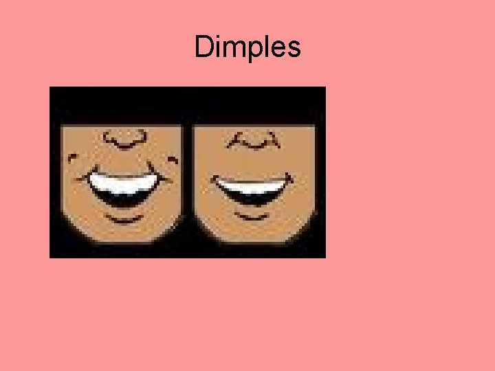 Dimples 