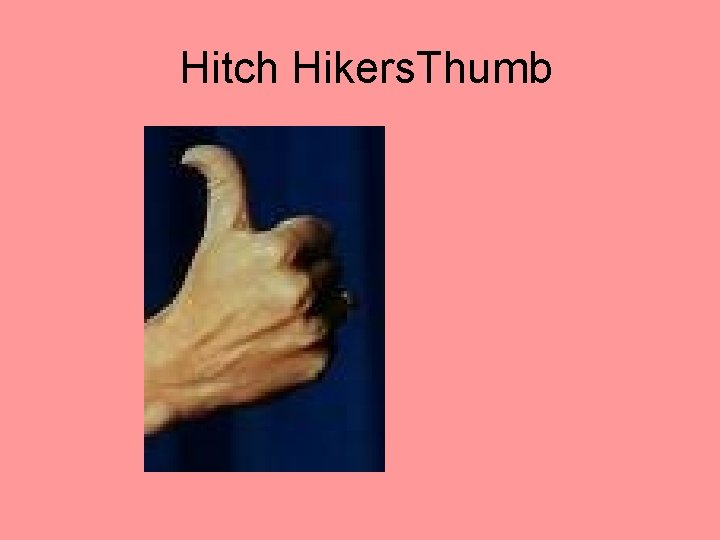 Hitch Hikers. Thumb 