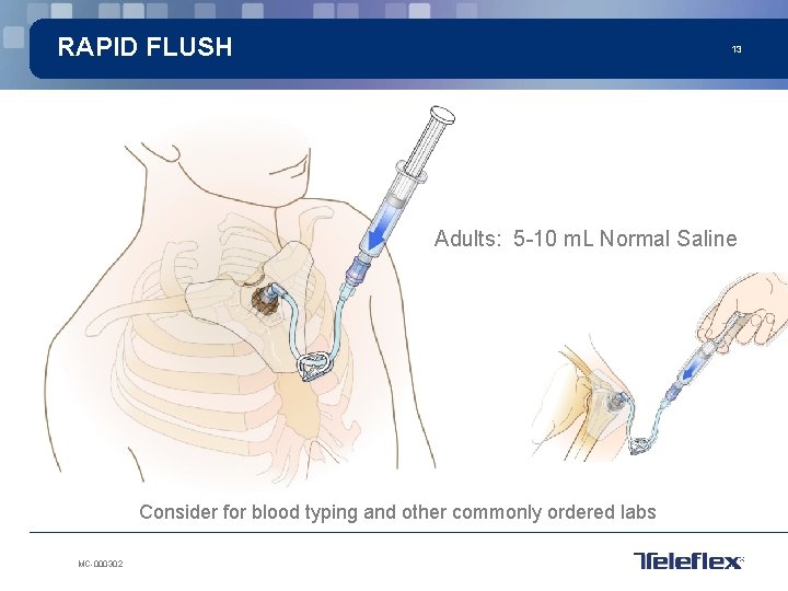 RAPID FLUSH 13 Adults: 5 -10 m. L Normal Saline Consider for blood typing