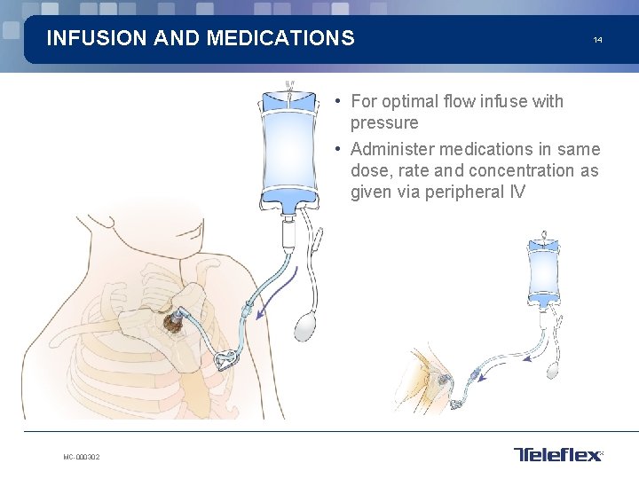 INFUSION AND MEDICATIONS 14 • For optimal flow infuse with pressure • Administer medications