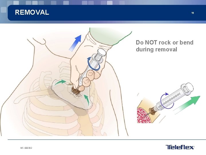 REMOVAL 18 Do NOT rock or bend during removal MC-000302 