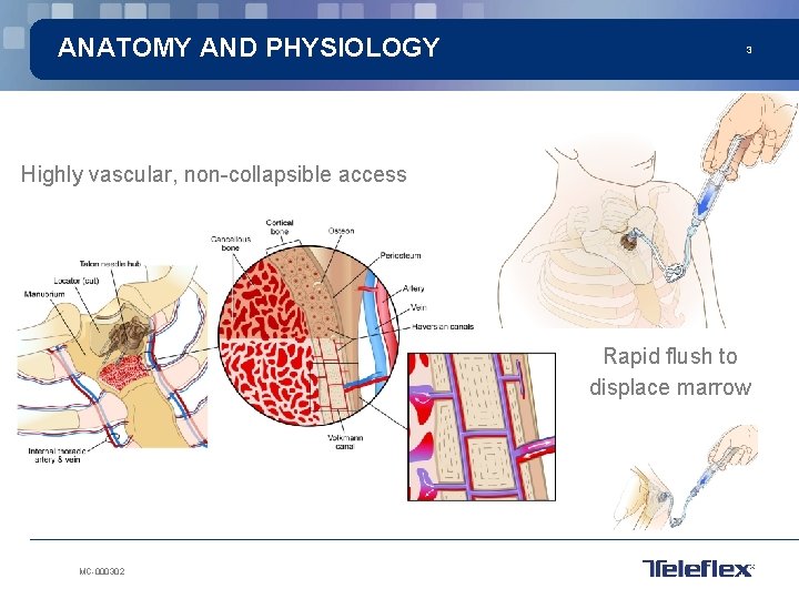 ANATOMY AND PHYSIOLOGY 3 Highly vascular, non-collapsible access Rapid flush to displace marrow MC-000302