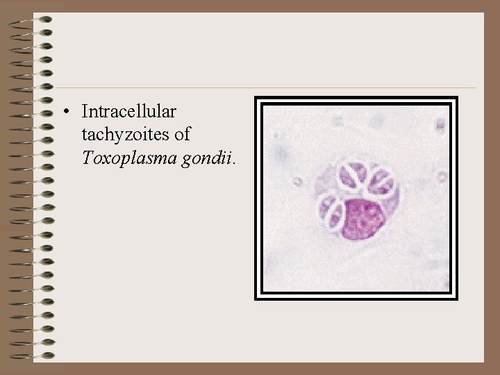  • Intracellular tachyzoites of Toxoplasma gondii. 