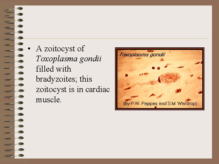  • A zoitocyst of Toxoplasma gondii filled with bradyzoites; this zoitocyst is in