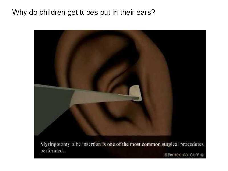 Why do children get tubes put in their ears? 