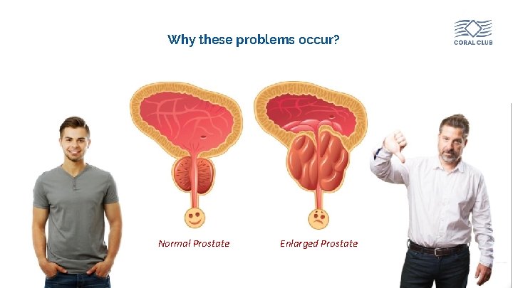 Why these problems occur? Normal Prostate www. coral-club. com Enlarged Prostate 