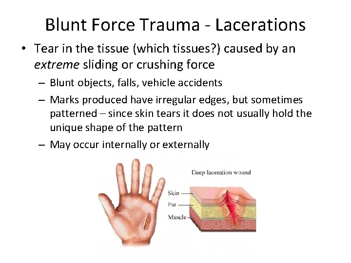 Blunt Force Trauma - Lacerations • Tear in the tissue (which tissues? ) caused