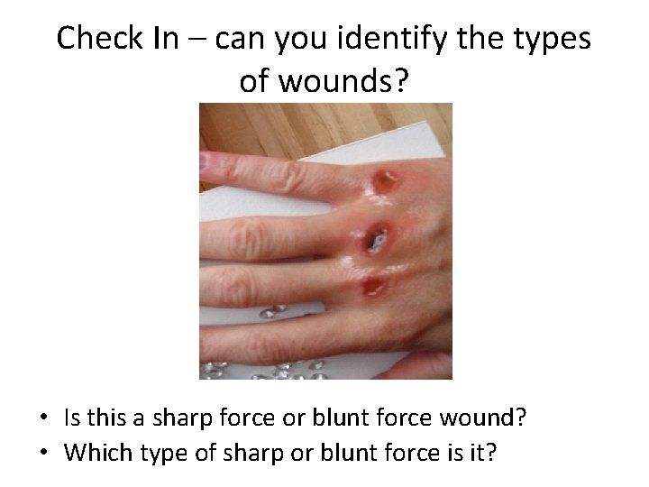 Check In – can you identify the types of wounds? • Is this a