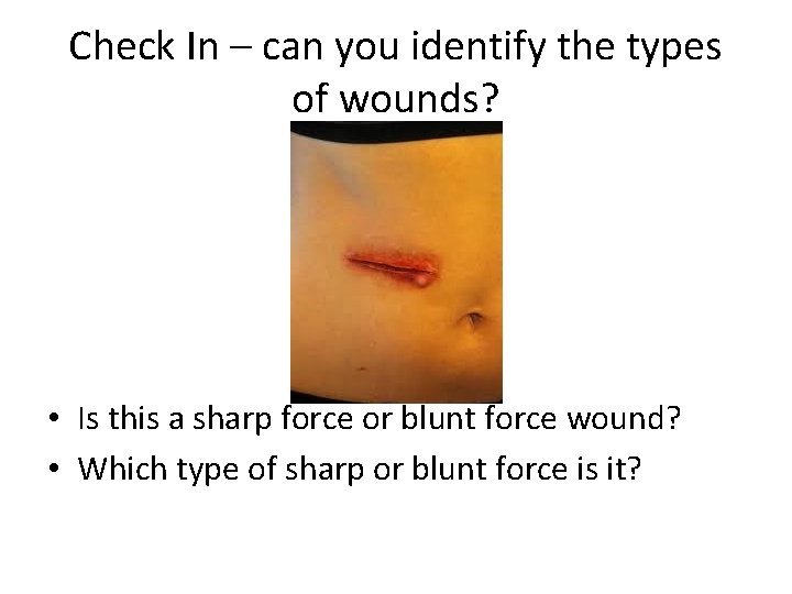 Check In – can you identify the types of wounds? • Is this a