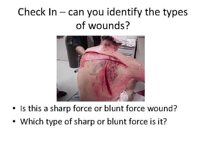 Check In – can you identify the types of wounds? • Is this a