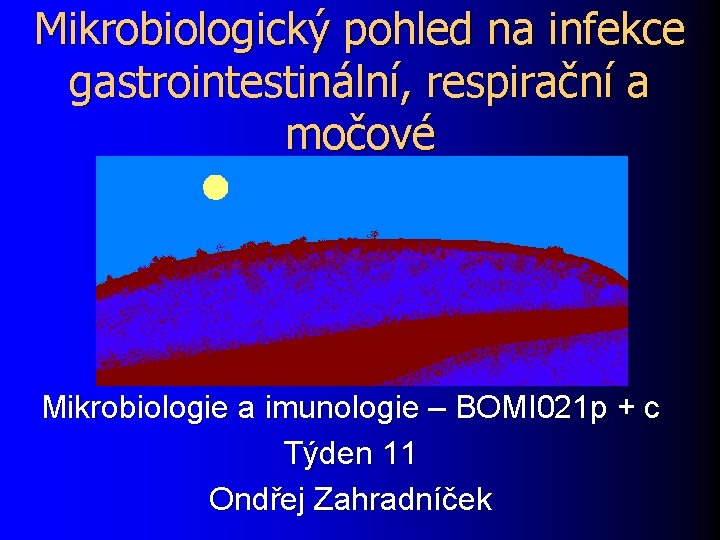 Mikrobiologický pohled na infekce gastrointestinální, respirační a močové Mikrobiologie a imunologie – BOMI 021