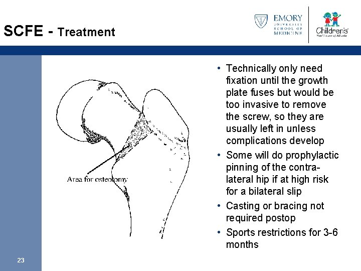 SCFE - Treatment • Technically only need fixation until the growth plate fuses but
