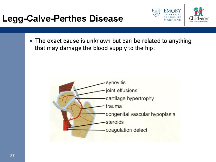 Legg-Calve-Perthes Disease § The exact cause is unknown but can be related to anything