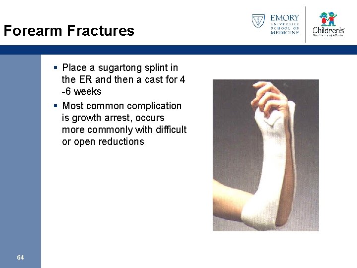 Forearm Fractures § Place a sugartong splint in the ER and then a cast
