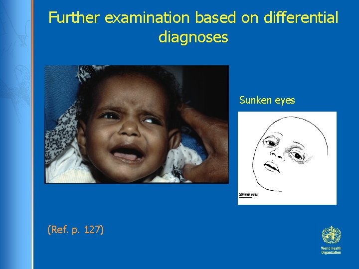 Further examination based on differential diagnoses Sunken eyes (Ref. p. 127) 