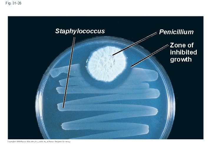 Fig. 31 -26 Staphylococcus Penicillium Zone of inhibited growth 