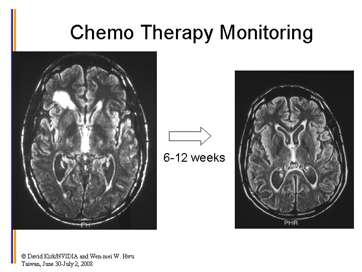 Chemo Therapy Monitoring 6 -12 weeks © David Kirk/NVIDIA and Wen-mei W. Hwu Taiwan,