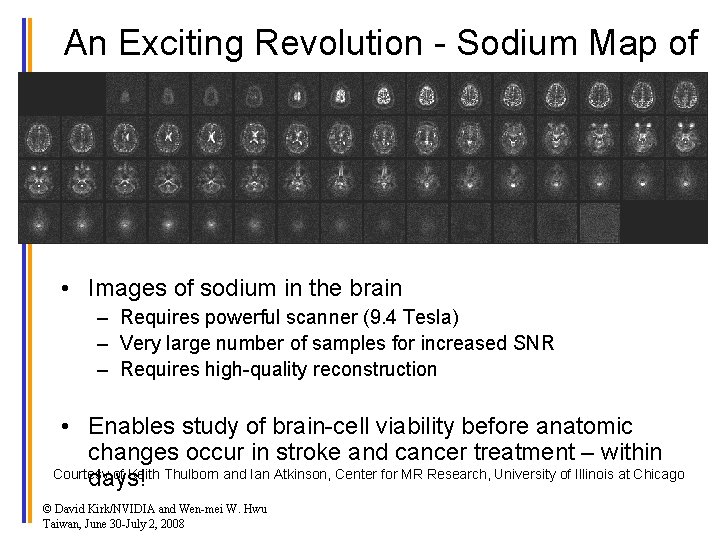 An Exciting Revolution - Sodium Map of the Brain • Images of sodium in