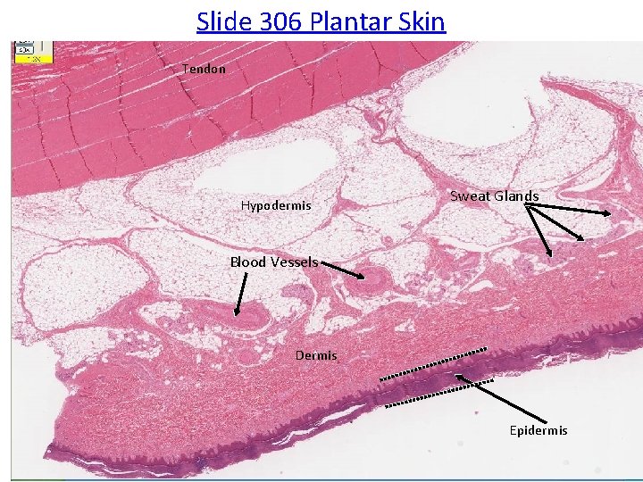 Slide 306 Plantar Skin Tendon Hypodermis Sweat Glands Blood Vessels Dermis Epidermis 