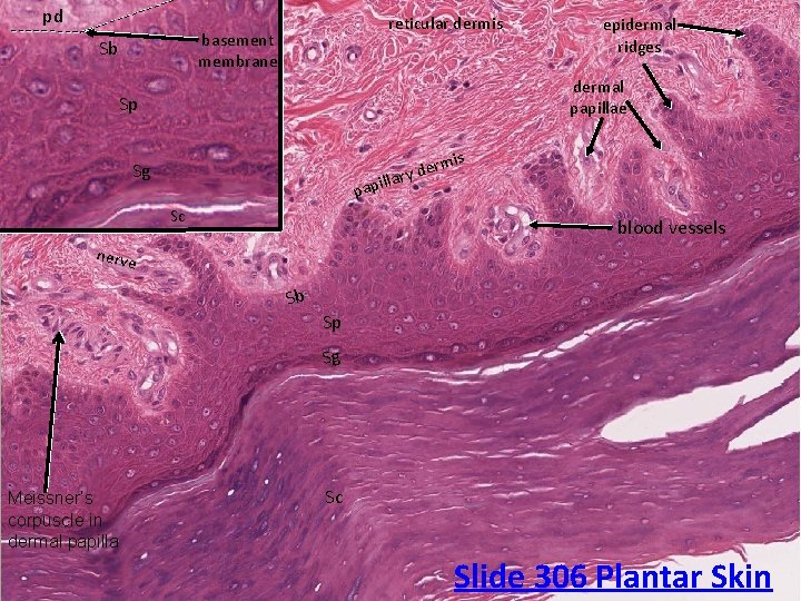 pd reticular dermis basement membrane Sb epidermal ridges dermal papillae Sp Sg ll papi