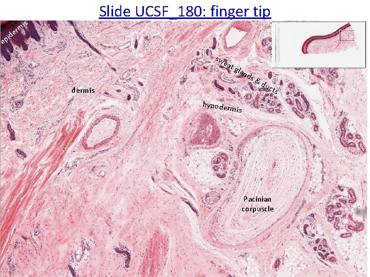 rm e d i Slide UCSF_180: finger tip is ep sw eat gla n