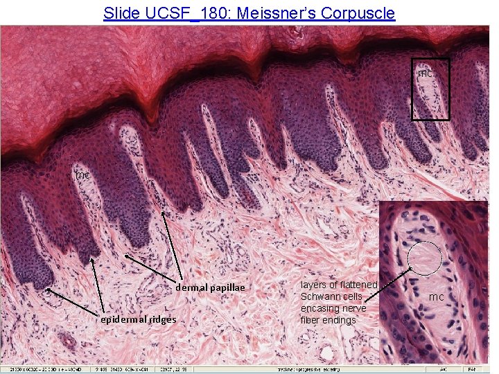 Slide UCSF_180: Meissner’s Corpuscle mc mc dermal papillae epidermal ridges layers of flattened Schwann