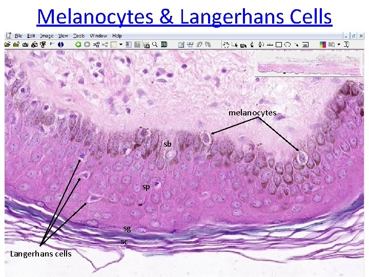 Melanocytes & Langerhans Cells melanocytes sb sp sg sc Langerhans cells 