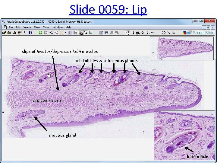 Slide 0059: Lip slips of levator/depressor labii muscles hair follicles & sebaceous glands orbicularis