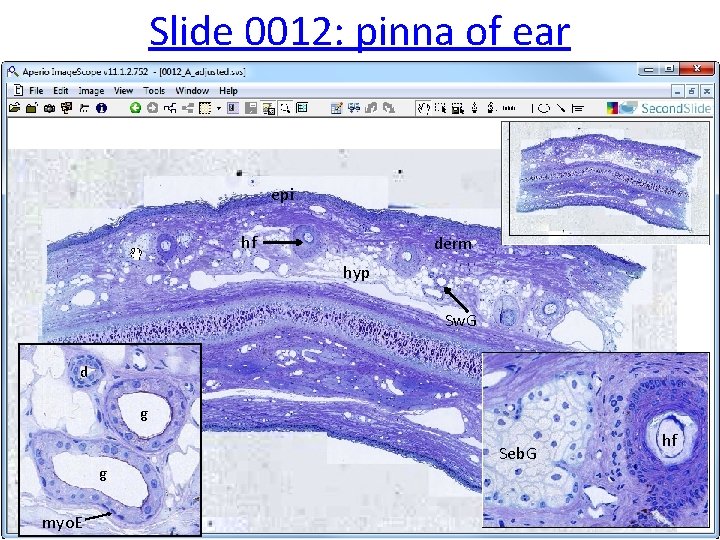 Slide 0012: pinna of ear epi hf derm hyp Sw. G d g g