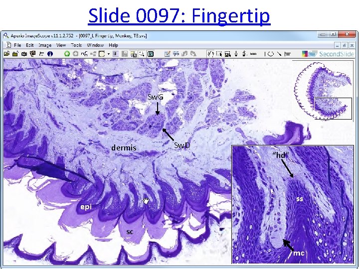 Slide 0097: Fingertip Sw. G dermis Sw. D “hd” ss epi sc mc 