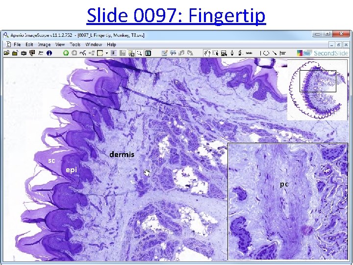 Slide 0097: Fingertip sc dermis epi pc 