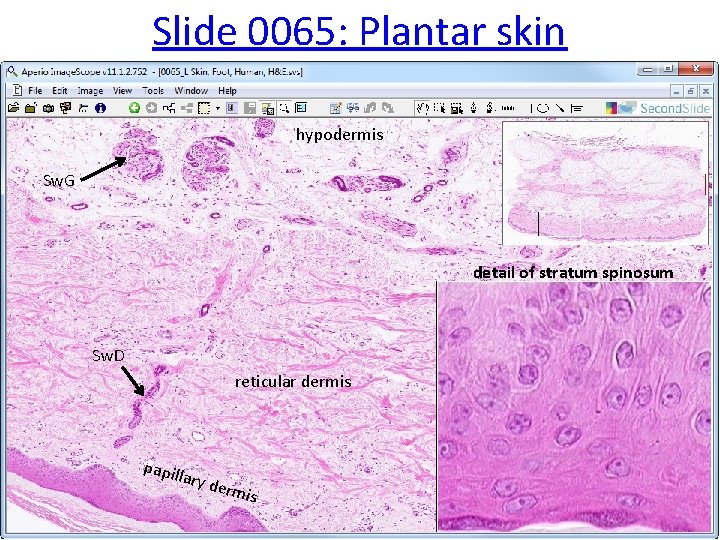 Slide 0065: Plantar skin hypodermis Sw. G detail of stratum spinosum Sw. D reticular