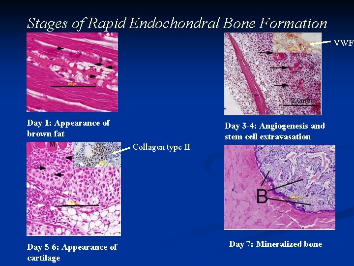 Stages of Rapid Endochondral Bone Formation VWF Day 1: Appearance of brown fat Day