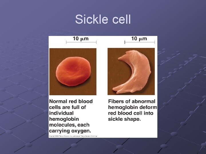 Sickle cell 