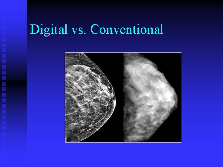 Digital vs. Conventional 