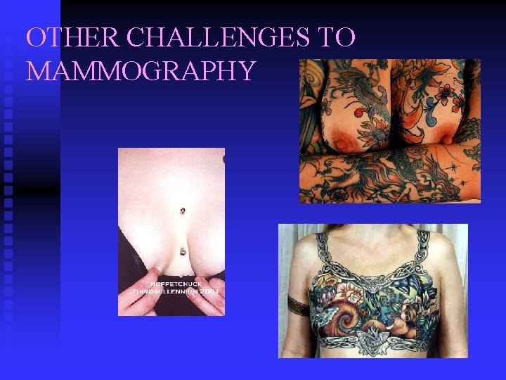 OTHER CHALLENGES TO MAMMOGRAPHY 