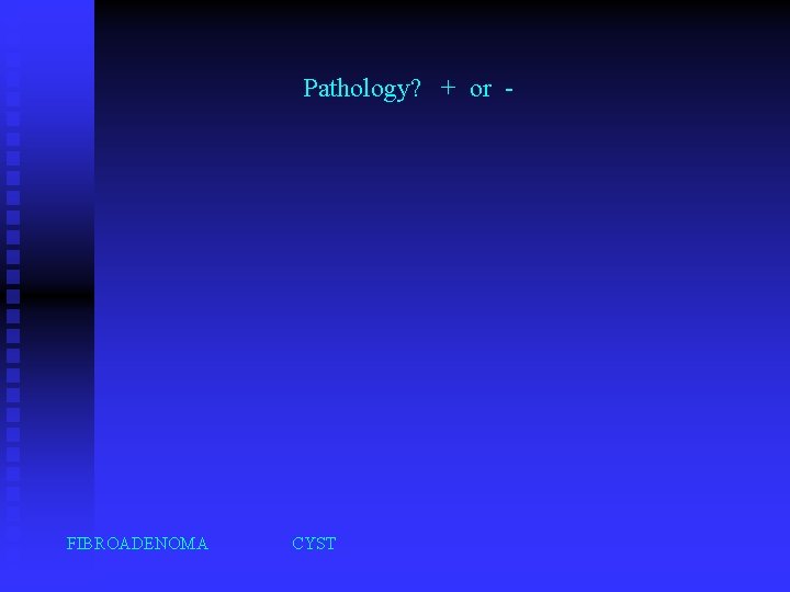 Pathology? + or - FIBROADENOMA CYST 
