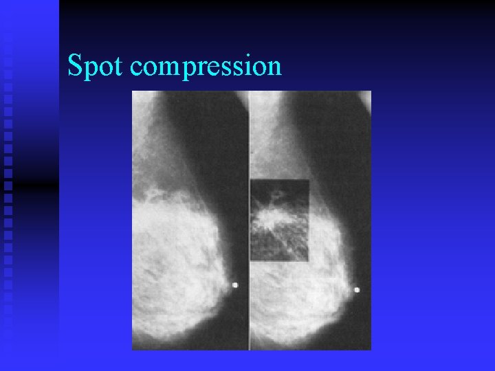 Spot compression 