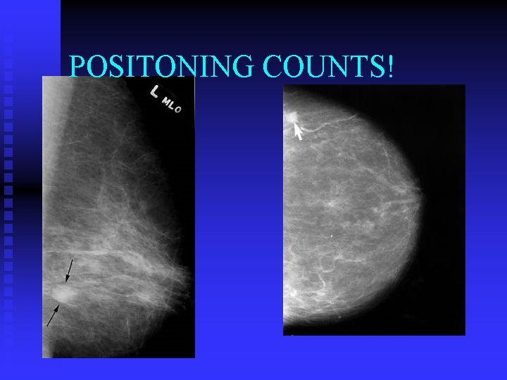 POSITONING COUNTS! 