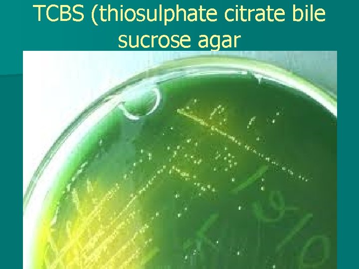 TCBS (thiosulphate citrate bile sucrose agar 