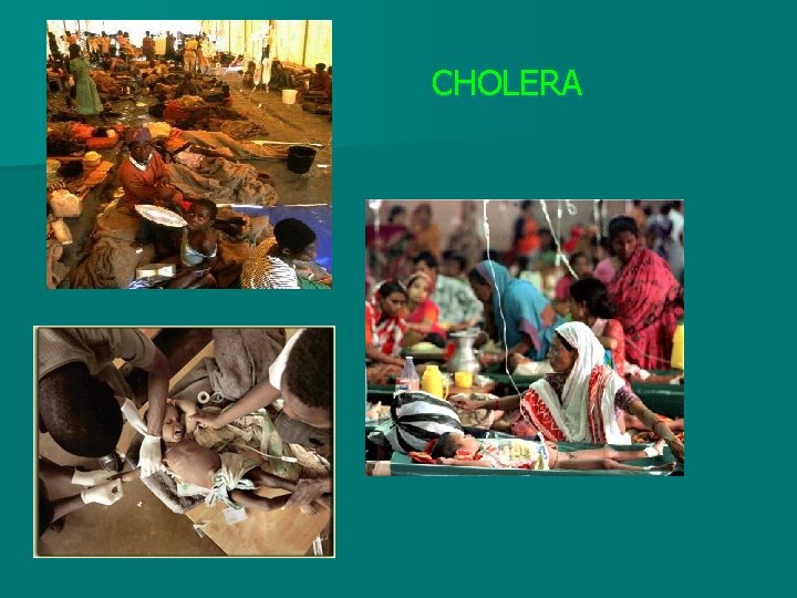 CHOLERA 