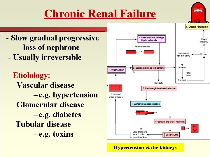 Chronic Renal Failure - Slow gradual progressive loss of nephrone - Usually irreversible Etiolology: